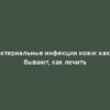 Бактериальные инфекции кожи: какие бывают, как лечить