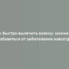 Как быстро вылечить экзему: можно ли избавиться от заболевания навсегда