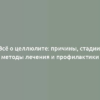 Всё о целлюлите: причины, стадии, методы лечения и профилактики