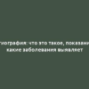 Ангиография: что это такое, показания и какие заболевания выявляет