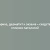 Псориаз, дерматит и экзема – сходства и отличия патологий