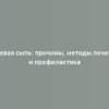 Угревая сыпь: причины, методы лечения и профилактика