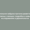 Учеными найдена причина развития экземы у женщин: подробно о новых исследованиях в дерматологии