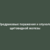 Предраковые поражения и опухоли щитовидной железы