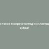 Что такое экспресс-метод имплантации зубов?