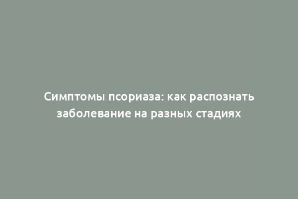 Симптомы псориаза: как распознать заболевание на разных стадиях