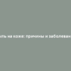 Сыпь на коже: причины и заболевания