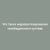 Что такое эндопротезирование тазобедренного сустава