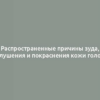 Распространенные причины зуда, шелушения и покраснения кожи головы