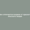 Чем отличается псориаз от красного плоского лишая