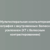 Мультиспиральная компьютерная томография с внутривенным болюсным усилением (КТ с болюсным контрастированием)