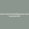 Лечение варусной деформации нижних конечностей