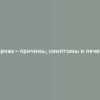 Псориаз – причины, симптомы и лечение