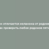 Чем отличается меланома от родинки? Как проверить любое родимое пятно