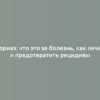 Псориаз: что это за болезнь, как лечить и предотвратить рецидивы