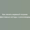 Как лечить нервный псориаз: эффективные методы и рекомендации