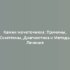 Камни мочеточника: Причины, Симптомы, Диагностика и Методы Лечения