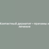 Контактный дерматит – причины и лечение