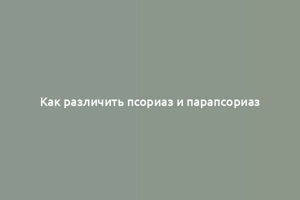 Как различить псориаз и парапсориаз